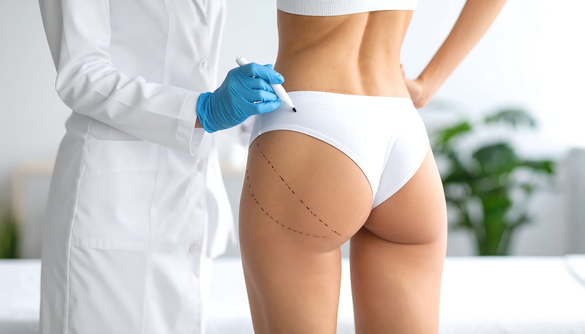 Proč se po BBL nesmí sedět: co to znamená v praxi
